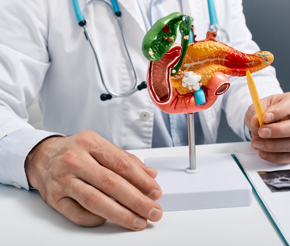 Treatment of pancreatic diseases, acute and chronic pancreatitis. Doctor showing pancreatic disease